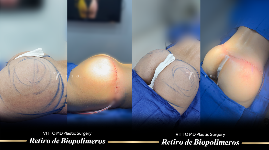 Antes y después: cómo leer correctamente una galería de resultados